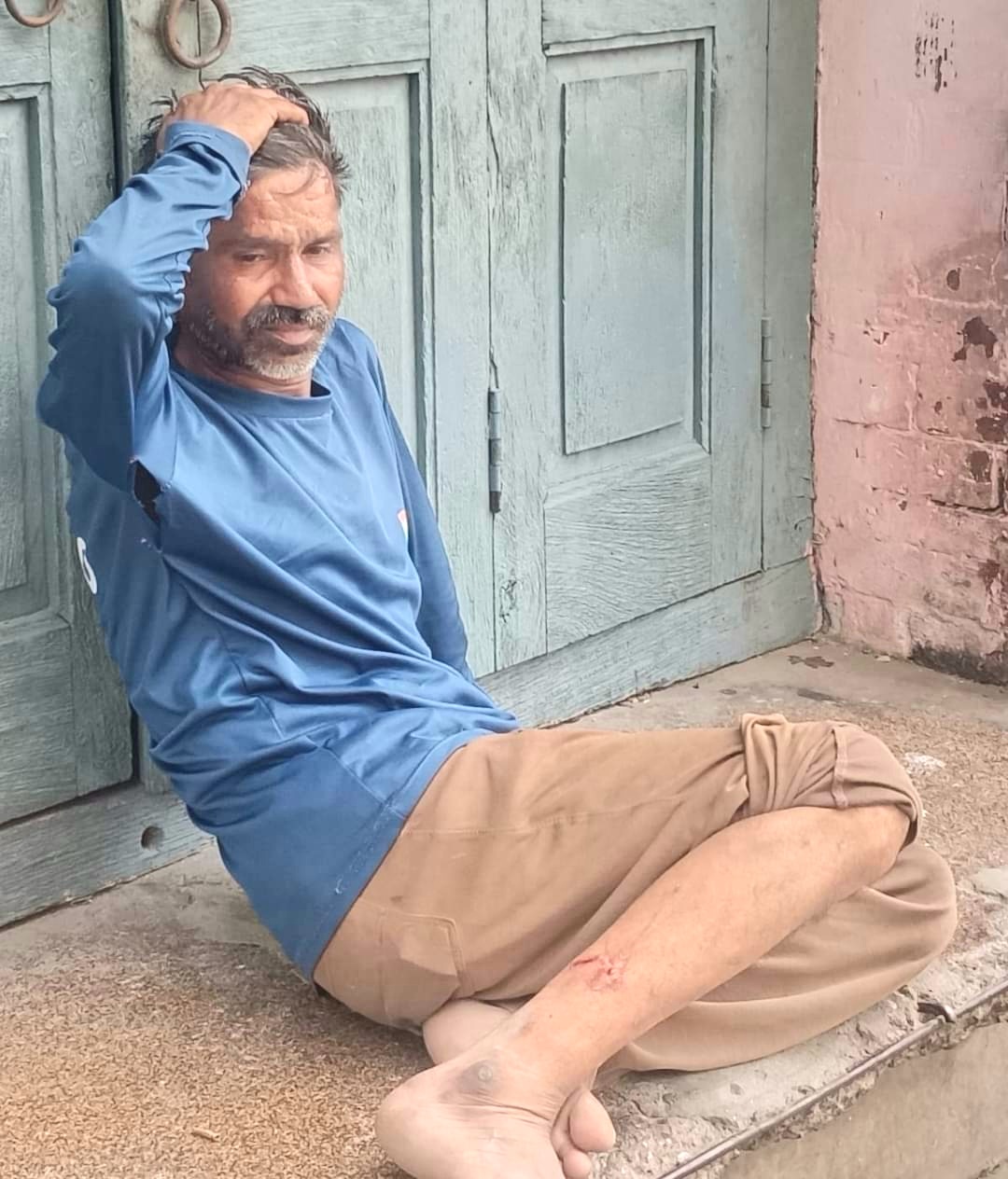 Municipal Corporation should give compensation to people injured by stray dogs - Ranjit Rana